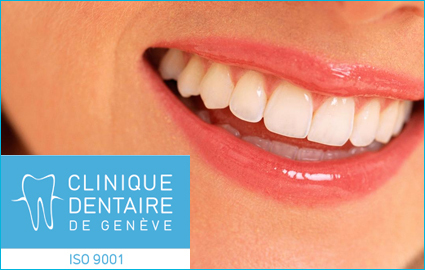 CHF99 instead of CHF152 for 1 hour Dental Cleaning with Qualified Dental Hygienist at Clinique Dentaire de Geneve  Photo
