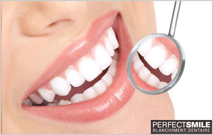 Get that beautiful smile: CHF 69 instead of 169 for safe & painless Teeth Whitening at Perfect Smile. Licensed by Swiss Federal Office, managed by qualified dentist  Photo