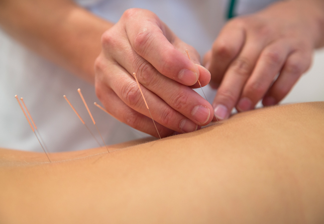 2 x Acupuncture Sessions at Institut Médicine de Champel by Mahin Bafghi: President of the Swiss Branch of Medicina Alternativa Europe 

Acupuncture's benefits incl pain relief, increased energy, less anxiety, weight management & more
 Photo