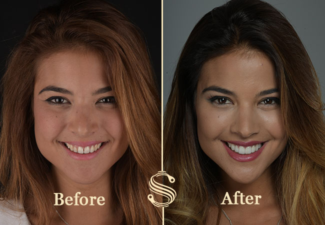 5 Stars on Google
Smile Design Boutique (Quai du Mont-Blanc): Dental Cleaning with Dentist Checkup / Teeth Whitening / Digital Smile DesignThis clinic offers innovative treatments, doctors with 20 years experience & beautiful facilities
 Photo