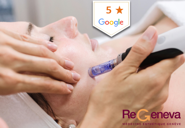 "Skin is tighter & smoother"  -ELLE
[Open during lockdown] Microneedling Facial at ReGeneva (near Airport): Rated 5 Stars on Google
This highly effective treatment - celebrated by the press - uses micro-needles to stimulate collagen production & to infuse the skin with hyaluronic acid & vitamins

 
 Photo