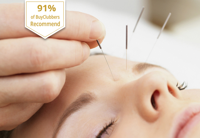 Recommended by 91% of BuyClubbers
​Chinese Tui Na Massage with Acupuncture Option at ​Qi Médicine Naturelle (near Cornavin)

Get relaxed & balanced with traditional treatments done by a certified therapist trained in China
 Photo