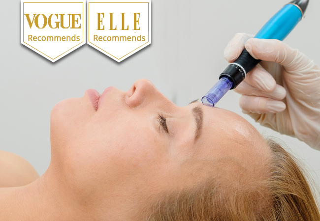 "One of the best ways for skin rejuvenation"  - VOGUE
1 or 4 Microneedling Facials at Groupe M&eacute;dical des Prairies (Servette)

Painless micro-needles naturally stimulate the skin's collagen production and infuse the dermis with hyaluronic acid & vitamin serum
 Photo