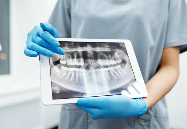 5* on Google Dental Cleaning at Summit Clinic (Vernier)

Recently opened clinic recommended by 94% of BuyClubbers. Options for whitening / dentist check-up 
 Photo