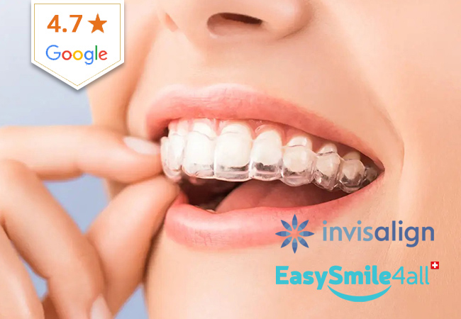 2'000-. Off Invisible Teeth Aligning at Easy Smile 4 All (Carouge)
