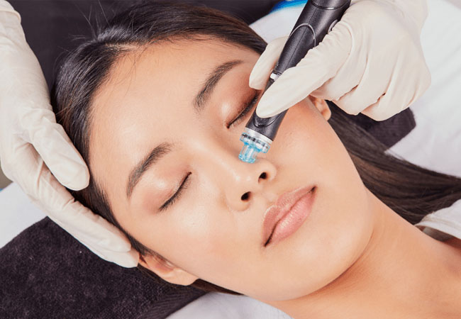 "Immediately effective" - ELLE Syndeo® Hydrafacial at Clinique Vitalise (Champel)Syndeo® is the newest & most advanced Hydrafacial, using patented technology to remove impurities & infuse the skin with antioxidants & hyaluronic acid
 Photo