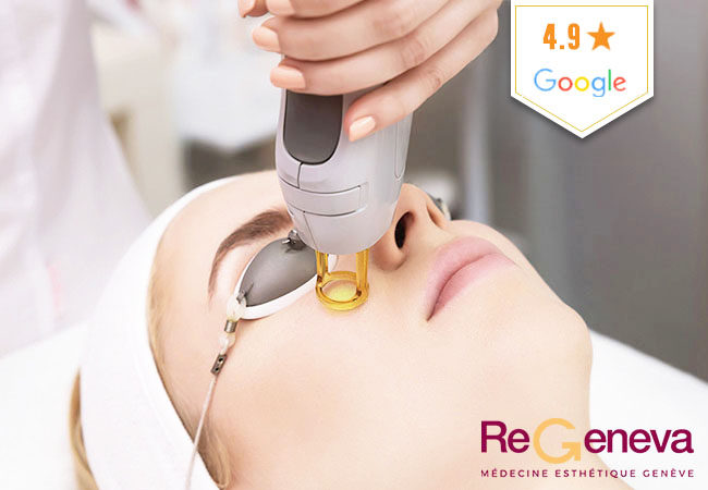 “Like a real-lif Instagram filter"  - VOGUE
1 or 3 Laser Genesis Facials at ReGeneva (near Airport): 4.9* on GoogleScientifically proven to stimulate the body's natural collagen production and reduce wrinkles. Recommended by 100% of BuyClubbers
 Photo