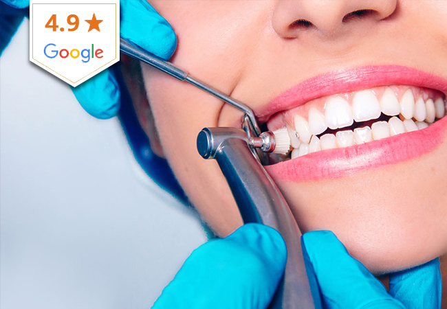 Dental Cleaning + Dentist Checkup at Dentovive (Eaux-Vives / Nyon)