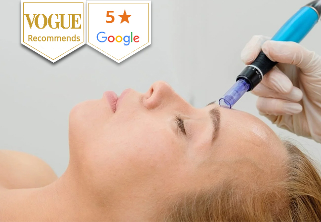 Exosome Microneedling at Capital Care Clinic (Central Geneva)