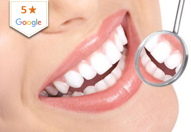 Dental Cleaning at iDental Studio (Carouge)