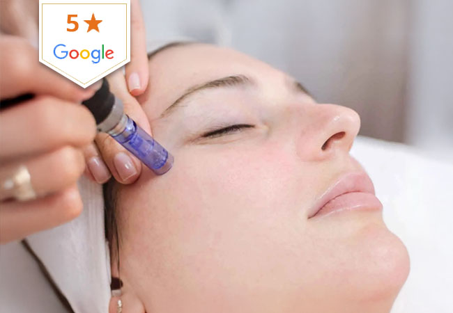 "Boosts glow & collagen" -VOGUE
Microneedling Facial with Glycolic Peel & LED Therapy at Clinique Vitalise (Champel): 5* on Google
Clinically-proven facial that boosts natural collagen product for "max skin rejuvenation & minimal downtime" (Vogue)
 Photo
