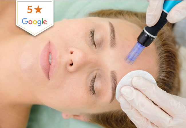 Microneedling Facial at Clinique Vitalise (Champel)