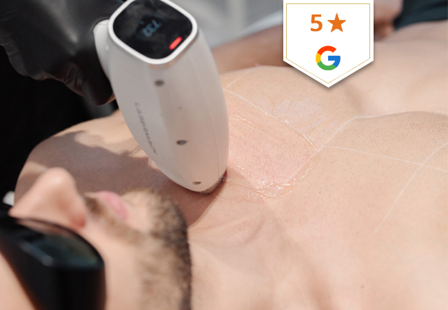 Laser Hair Removal at Capital Care Clinic (Center)